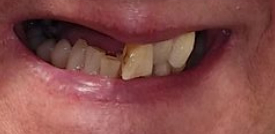 After