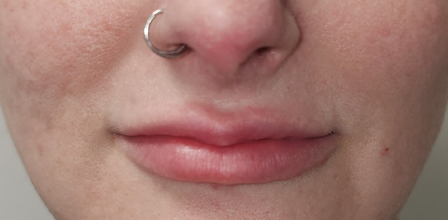 Before