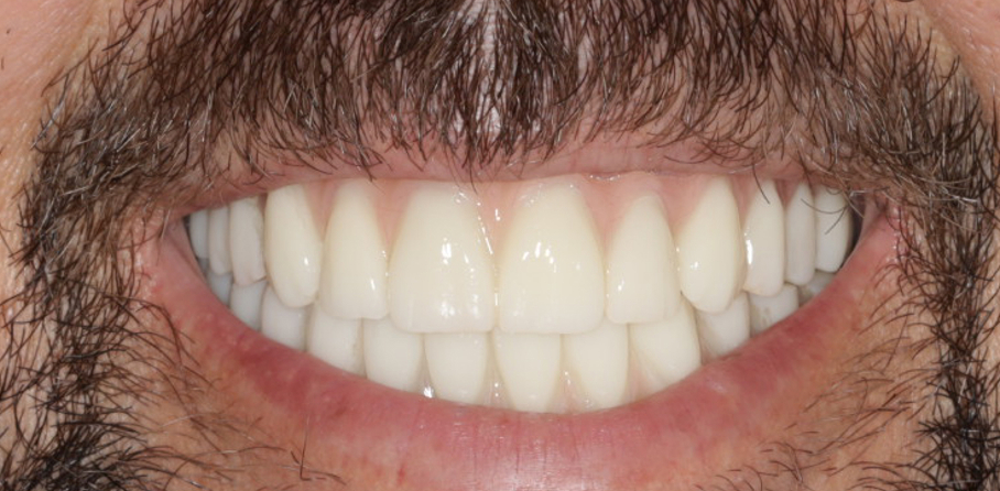 Before