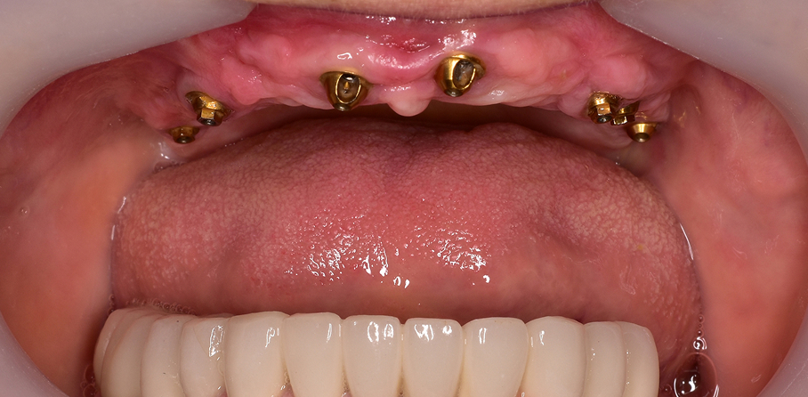 After